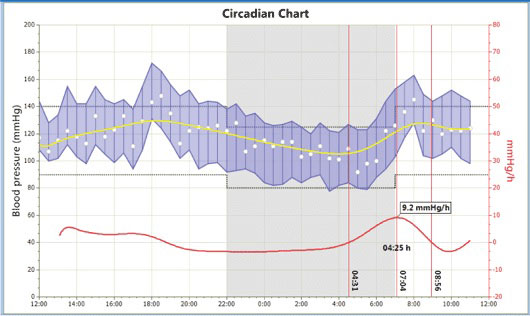 Beneware - Ambulatory Blood Pressure Monitor